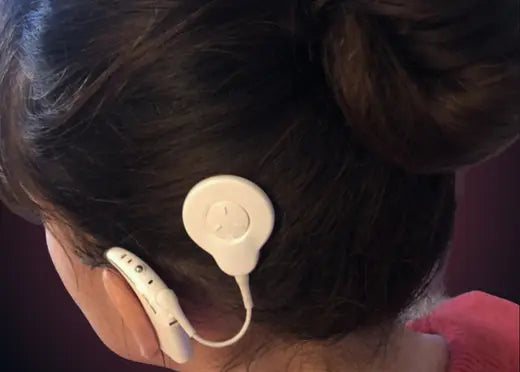 Implant cochléaire porté par une jeune femme